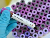 Первые случаи заражения коронавирусом обнаружены еще в четырех странах