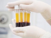В США провели более 35 тыс. переливаний плазмы крови людей, переболевших COVID-19