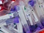 В Чехии рекордный прирост выявленных случаев коронавируса