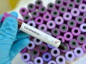 Коронавирус грозит сексуальному здоровью: почему COVID-19 вызывает импотенцию